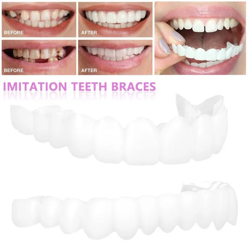 Remarkable Teeth Veneers