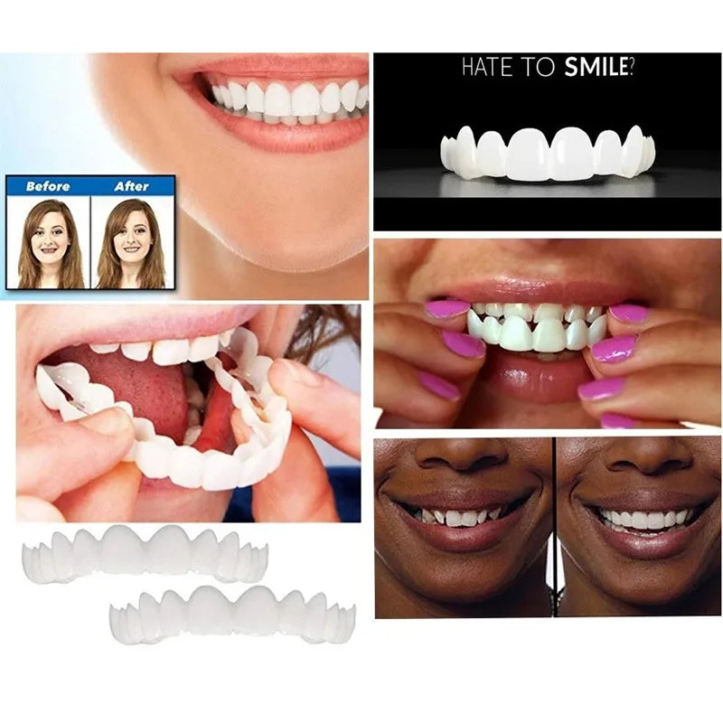 Remarkable Teeth Veneers