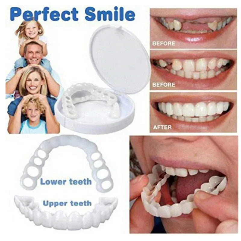 Remarkable Teeth Veneers