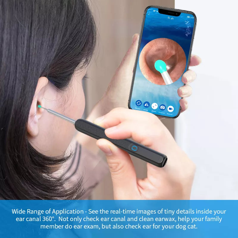 Smart Visual Ear Cleaning Kit