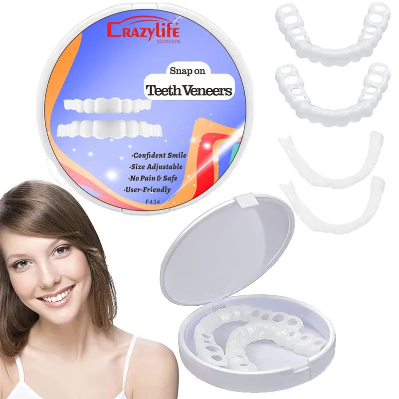 Remarkable Teeth Veneers