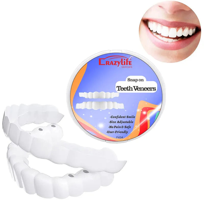 Remarkable Teeth Veneers